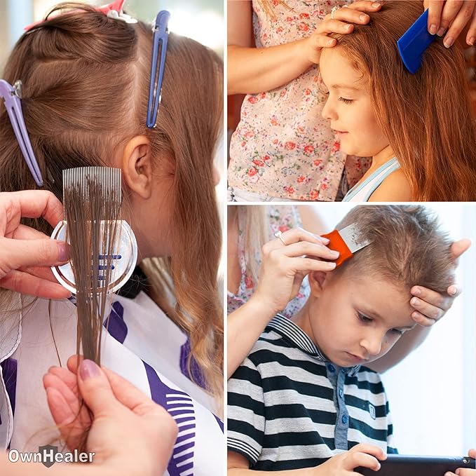 OWNHEALER Professional Lice Comb Kit - for Lice, Nits, and Dandruff Removal. Quick Results for Head Lice Treatment - Suitable for All Hair Types. Peine para piojos y liendres.